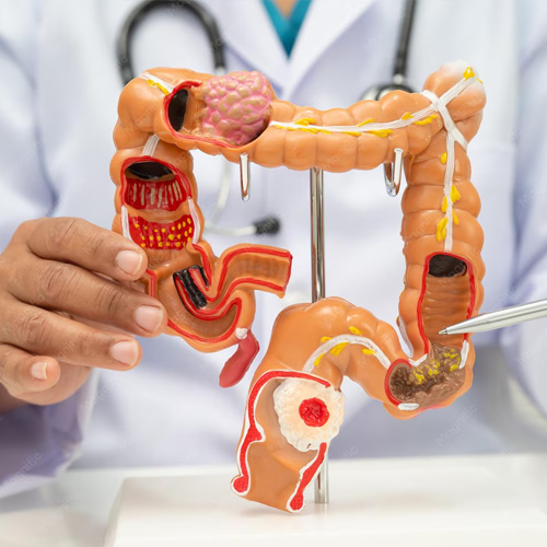Colorectal Surgery