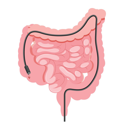 Endoscopy & Colonoscopy