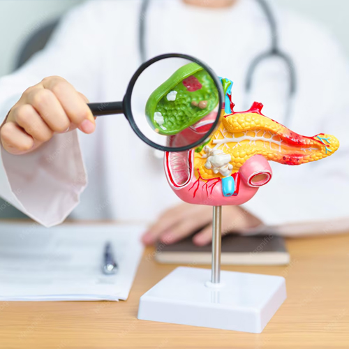 Gallbladder & Bile Duct Surgery