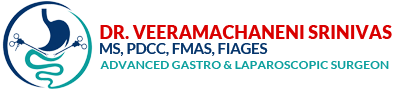 Dr. Veeramachaneni Srinivas, Advanced Gastro and Laparoscopic Surgeon